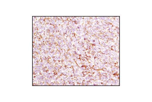 Immunohistochemistry Image 4: β-Actin (13E5) Rabbit mAb (BSA and Azide Free)
