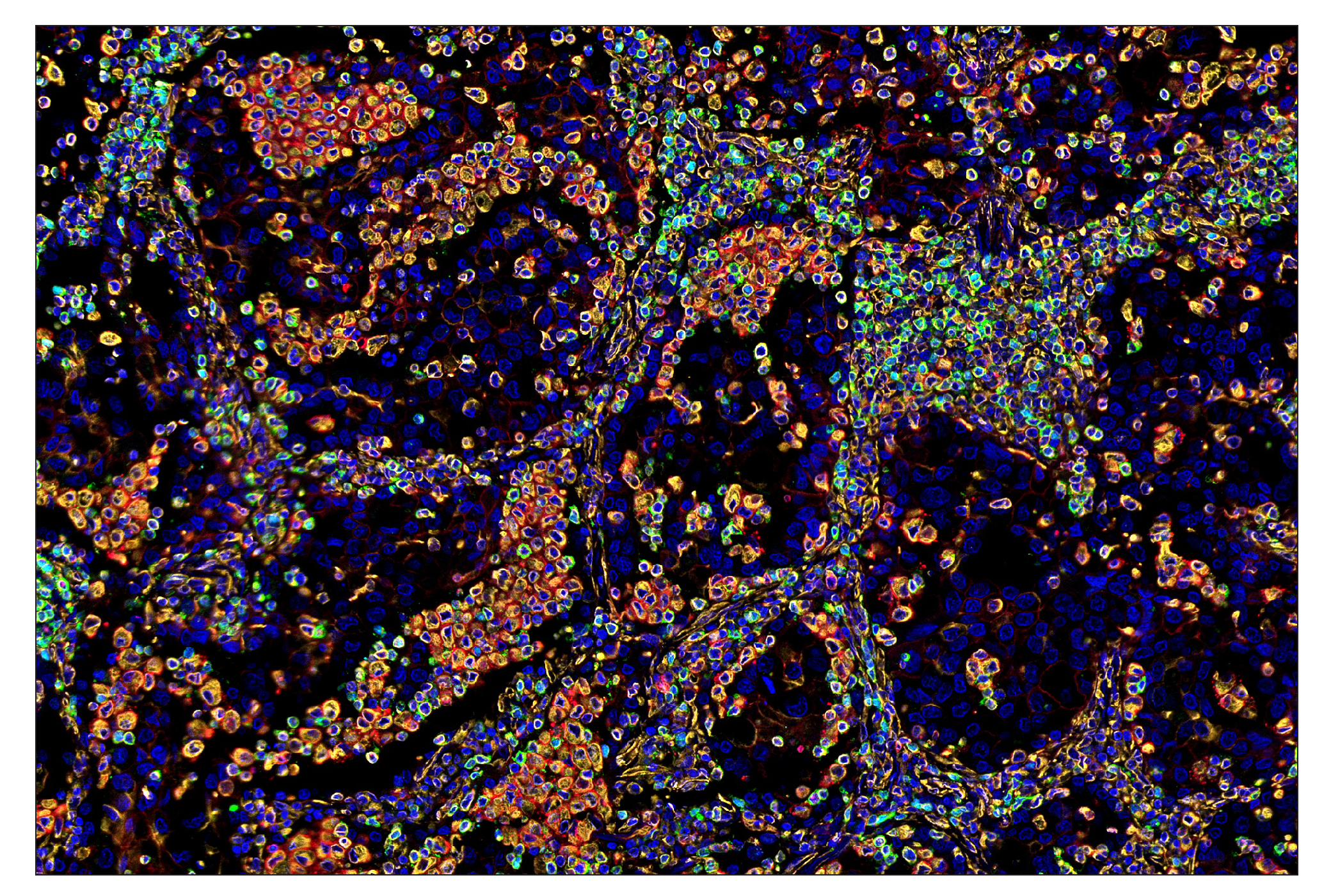 Immunohistochemistry Image 7: Vimentin (D21H3) & CO-0012-488 SignalStar™ Oligo-Antibody Pair