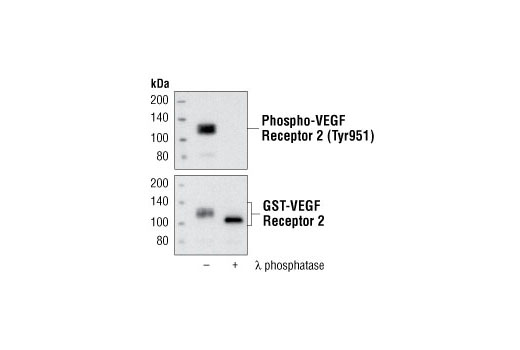 Western Blotting Image 1: Phospho-VEGF Receptor 2 (Tyr951) (15D2) Rabbit mAb
