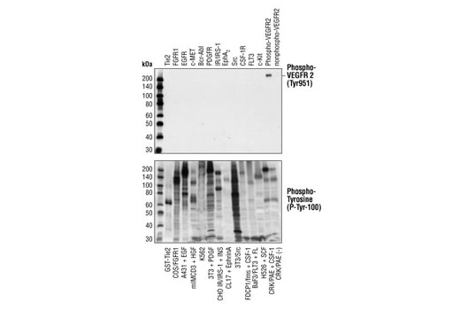 Western Blotting Image 2: Phospho-VEGF Receptor 2 (Tyr951) (15D2) Rabbit mAb