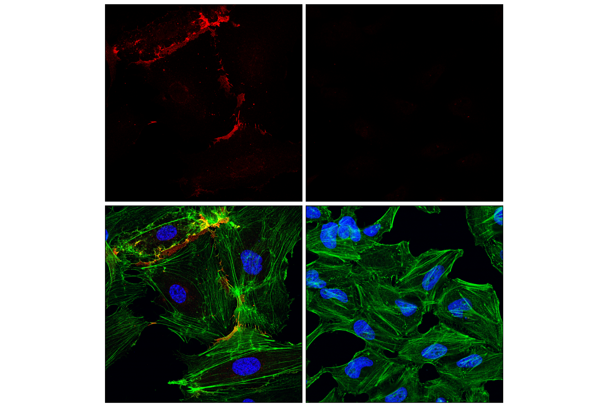 Immunofluorescence Image 1: CD31 (PECAM-1) (89C2) Mouse mAb (Alexa Fluor® 647 Conjugate)