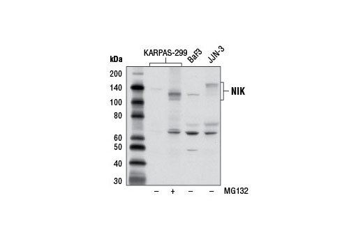  Image 9: NF-κB Non-Canonical Pathway Antibody Sampler Kit