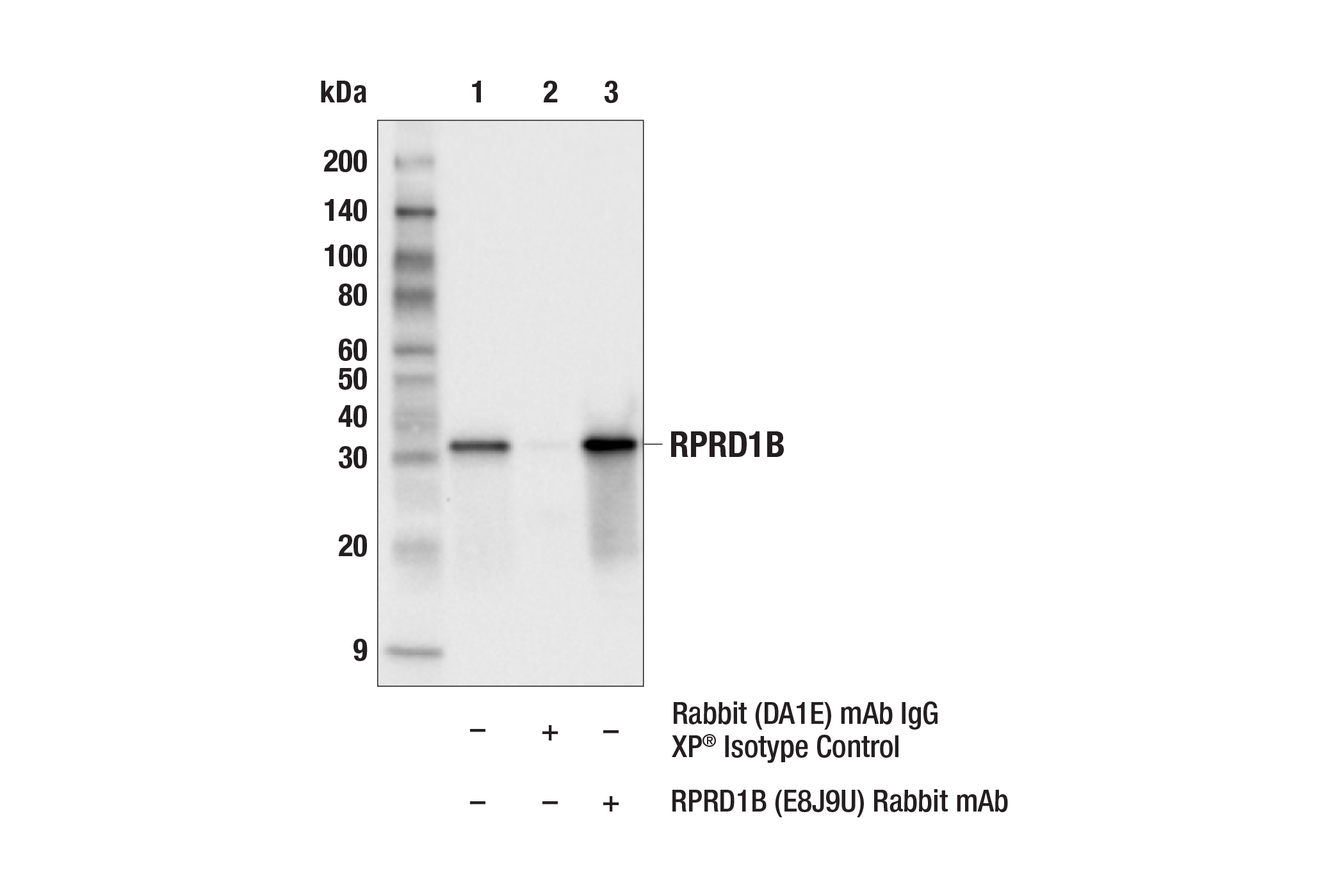 Immunoprecipitation Image 1: RPRD1B (E8J9U) Rabbit mAb