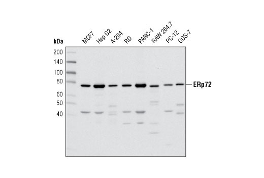  Image 7: ER and Golgi-Associated Marker Proteins Antibody Sampler Kit