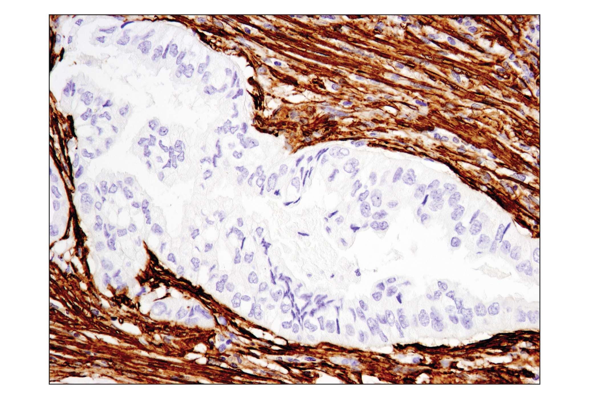 Immunohistochemistry Image 5: α-Smooth Muscle Actin (D4K9N) XP® Rabbit mAb (BSA and Azide Free)