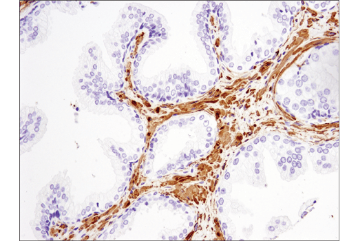 Immunohistochemistry Image 5: α-Smooth Muscle Actin (D4K9N) XP® Rabbit mAb (BSA and Azide Free)