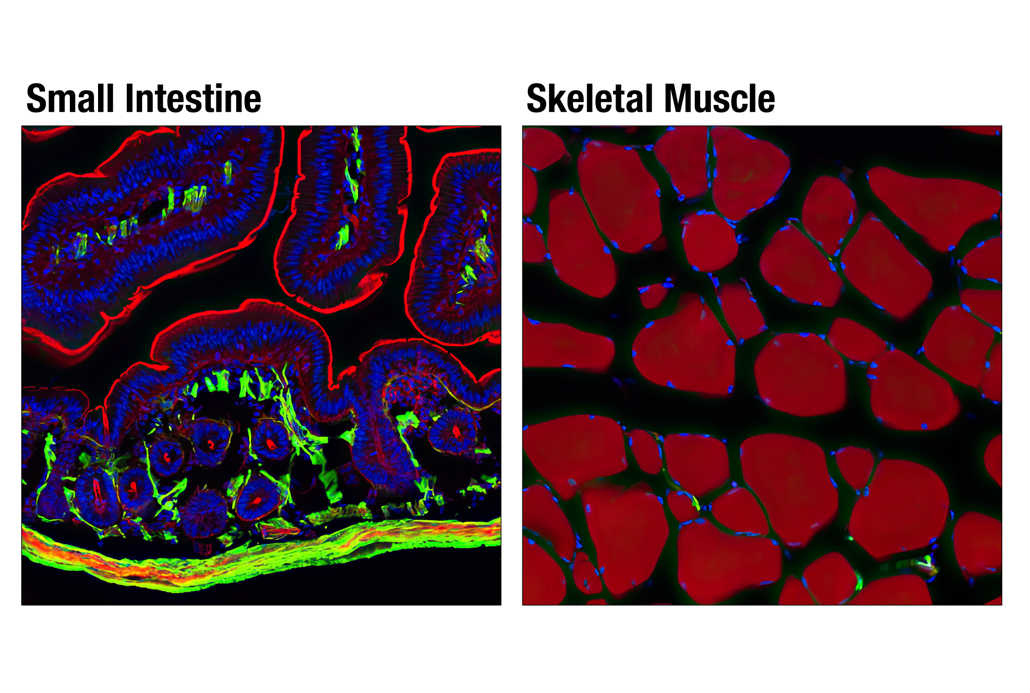 Immunofluorescence Image 1: α-Smooth Muscle Actin (D4K9N) XP® Rabbit mAb (BSA and Azide Free)