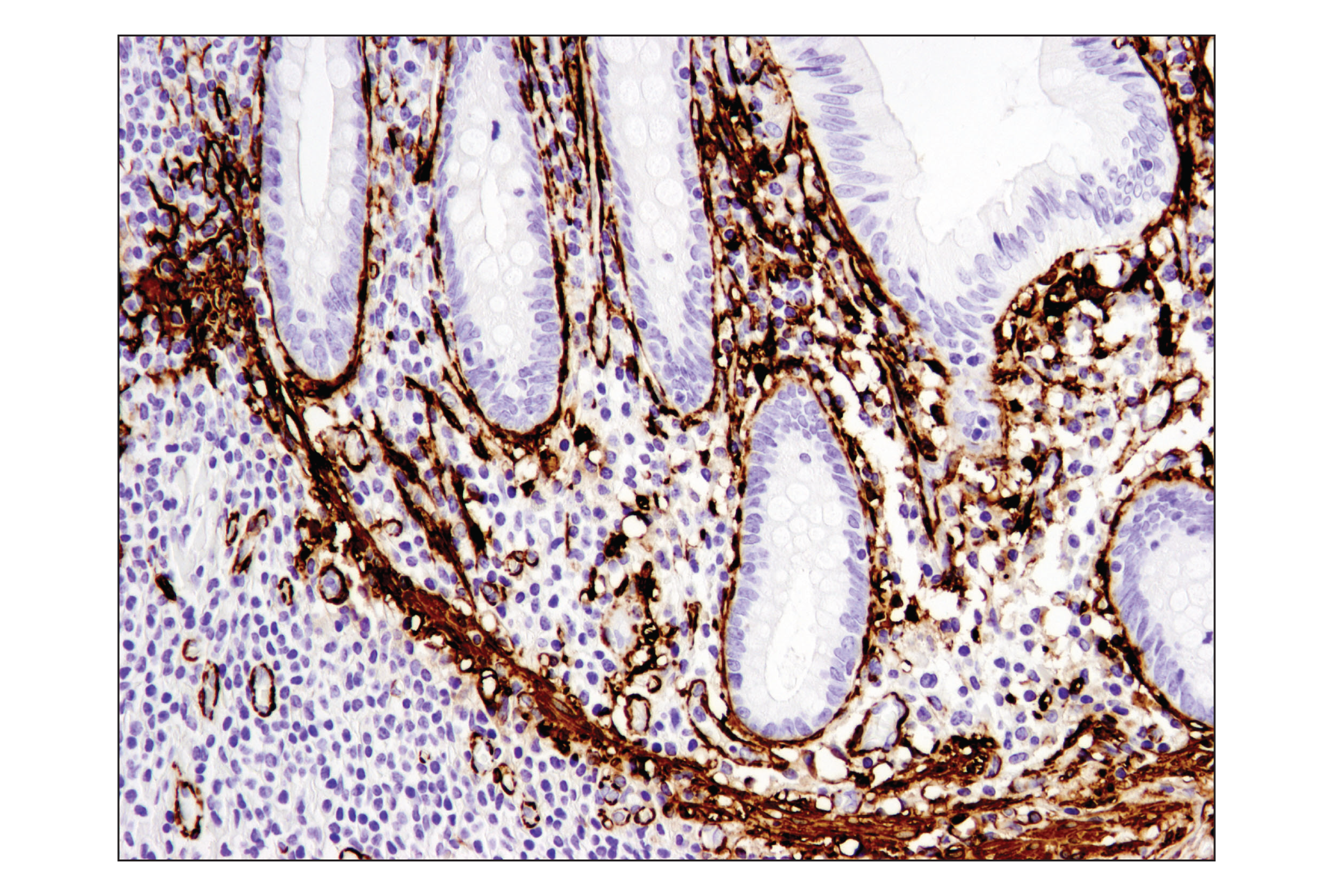 Immunohistochemistry Image 2: α-Smooth Muscle Actin (D4K9N) XP® Rabbit mAb (BSA and Azide Free)