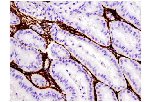 Immunohistochemistry Image 1: α-Smooth Muscle Actin (D4K9N) XP® Rabbit mAb (BSA and Azide Free)