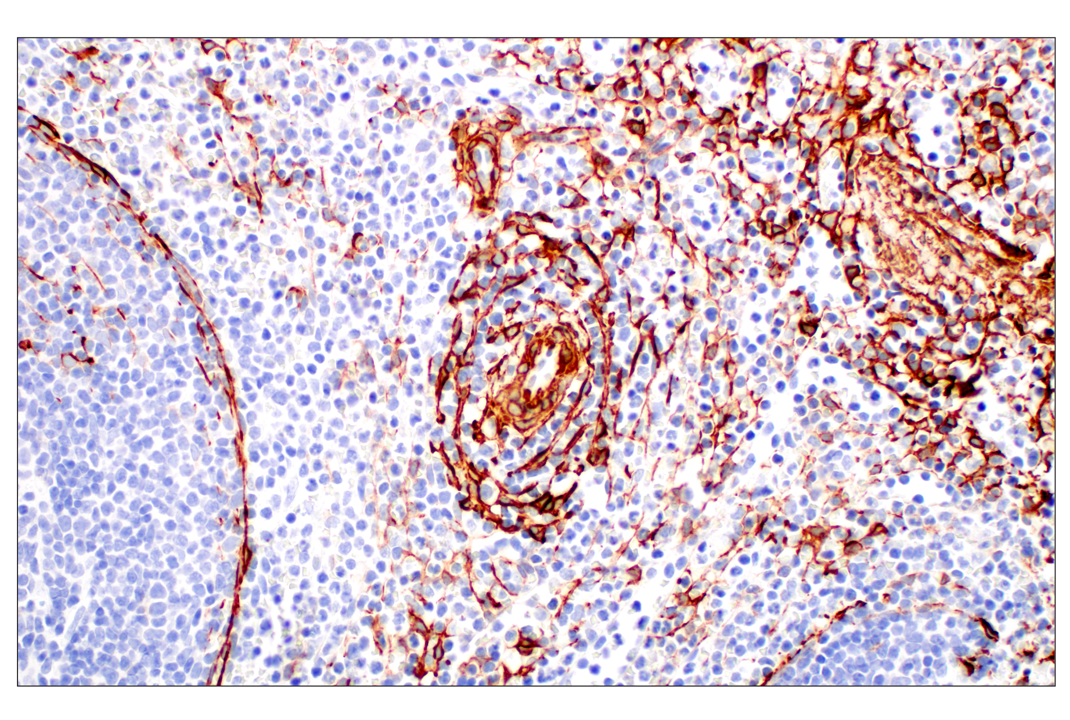 Immunohistochemistry Image 10: α-Smooth Muscle Actin (D4K9N) XP® Rabbit mAb (BSA and Azide Free)