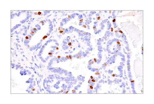 Immunohistochemistry Image 1: ATAD2 (E8Y7F) Rabbit mAb