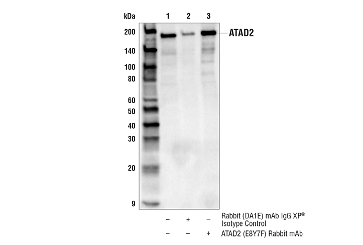 Immunoprecipitation Image 1: ATAD2 (E8Y7F) Rabbit mAb