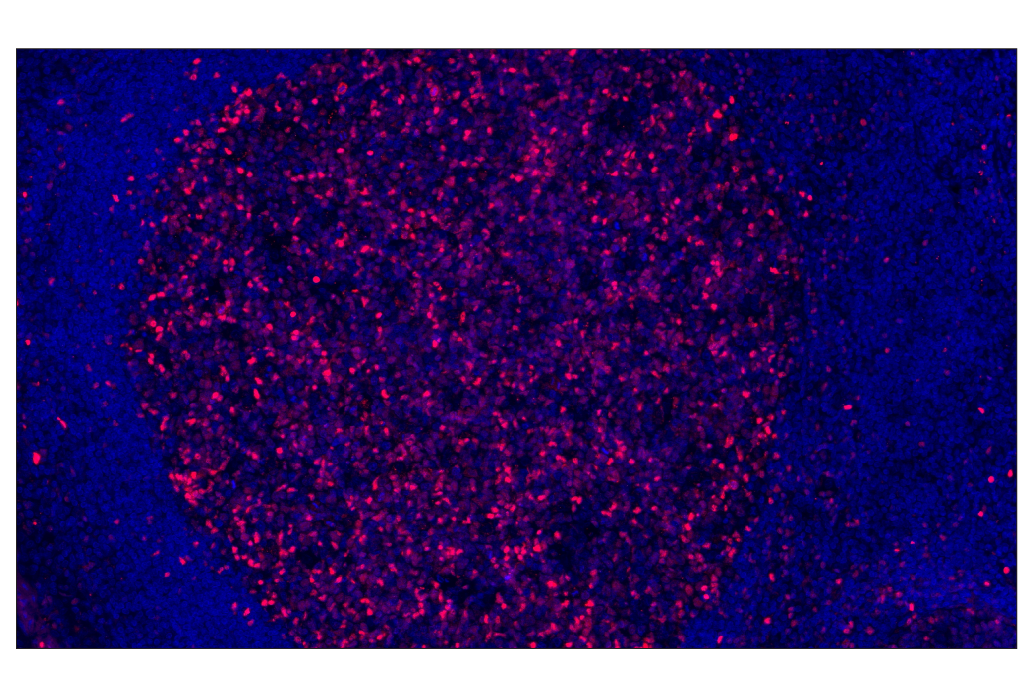 Immunohistochemistry Image 1: Tox/Tox2 (E6I3Q) Rabbit mAb (Alexa Fluor® 555 Conjugate)