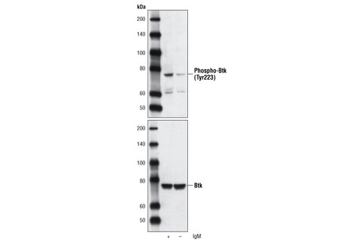 Western Blotting Image 1: Phospho-Btk (Tyr223) Antibody