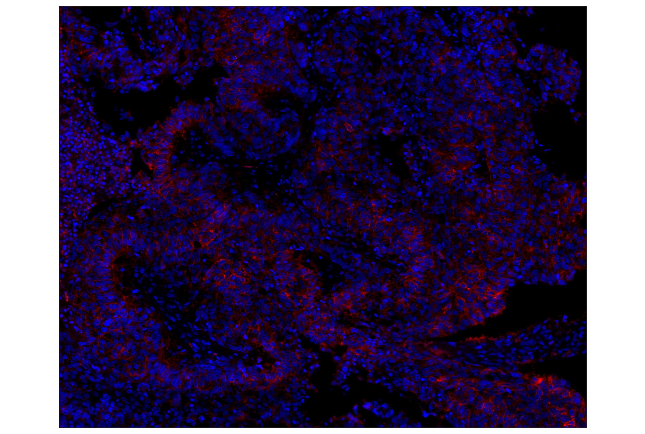Immunohistochemistry Image 1: NCAM1 (CD56) (E7X9M) XP® Rabbit mAb (Alexa Fluor® 647 Conjugate)