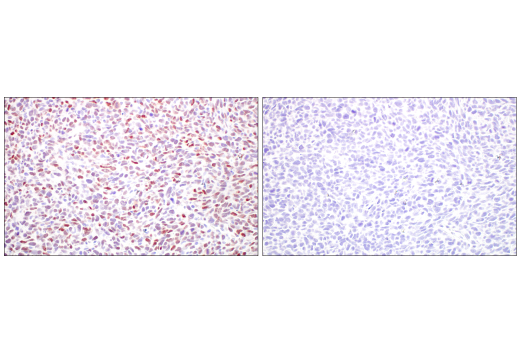 Immunohistochemistry Image 6: TWIST1 (E2M5V) Rabbit mAb
