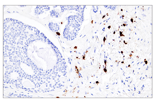 Immunohistochemistry Image 5: CD38 (E7Z8C) XP® Rabbit mAb