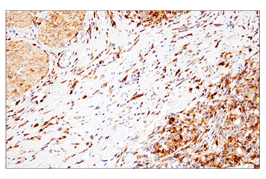 Immunohistochemistry Image 9: CD38 (E7Z8C) XP® Rabbit mAb