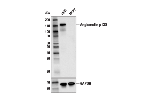 Western Blotting Image 1: Angiomotin (E3E7X) Rabbit mAb