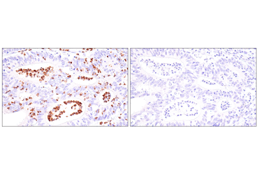 Immunohistochemistry Image 7: CEACAM6 (E7S7Y) Rabbit mAb (BSA and Azide Free)