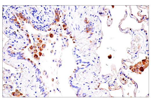 Immunohistochemistry Image 5: CEACAM6 (E7S7Y) Rabbit mAb (BSA and Azide Free)