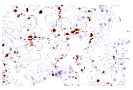 Immunohistochemistry Image 1: CEACAM6 (E7S7Y) Rabbit mAb (BSA and Azide Free)