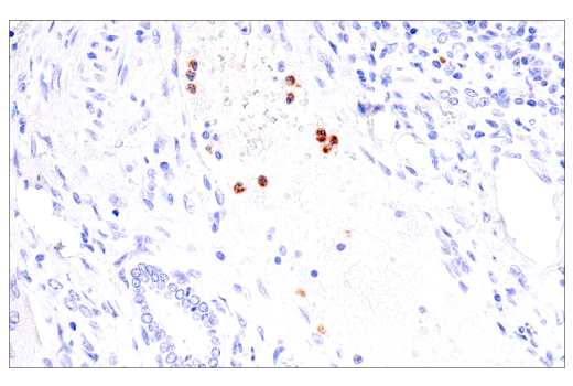 Immunohistochemistry Image 4: CEACAM6 (E7S7Y) Rabbit mAb (BSA and Azide Free)