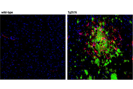 Immunofluorescence Image 1: β-Amyloid (D54D2) XP® Rabbit mAb (Alexa Fluor® 488 Conjugate)