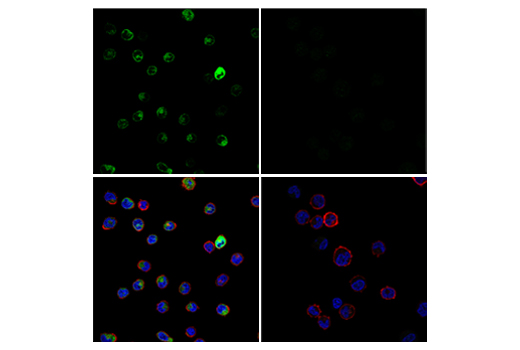 Immunofluorescence Image 1: Tryptase (E9R8A) Rabbit mAb