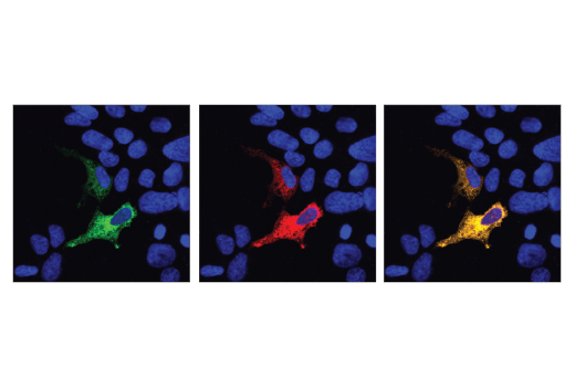 Immunofluorescence Image 1: Cas9 (S. aureus) (E4G3U) Rabbit mAb