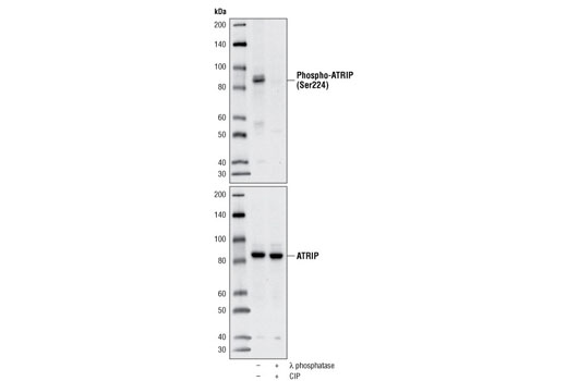 Western Blotting Image 1: Phospho-ATRIP (Ser224) Antibody
