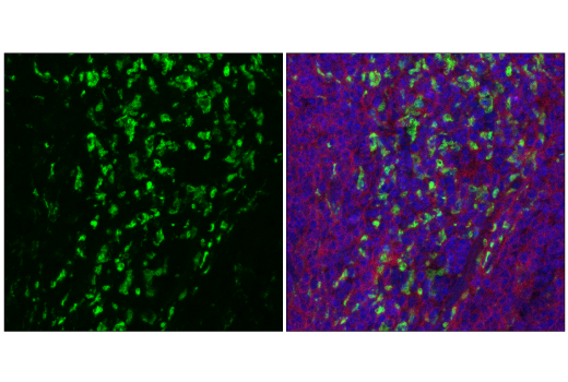 Immunofluorescence Image 2: CD68 (E3O7V) Rabbit mAb (Alexa Fluor® 488 Conjugate)
