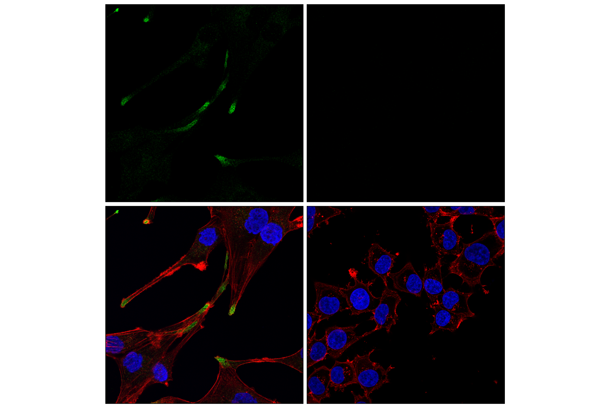 Immunofluorescence Image 1: AIFM2/FSP1 (F7A3L) Rabbit mAb