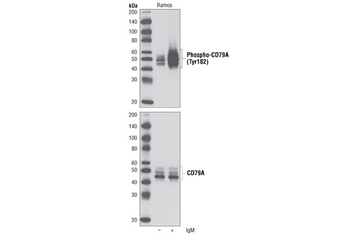 Western Blotting Image 1: Phospho-CD79A (Tyr182) Antibody