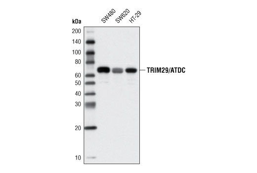 Western Blotting Image 1: TRIM29/ATDC Antibody