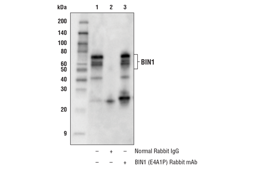 Immunoprecipitation Image 1: BIN1 (E4A1P) Rabbit mAb