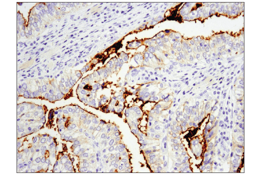 Immunohistochemistry Image 1: CD133 (D2V8Q) XP® Rabbit mAb (BSA and Azide Free)