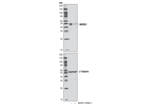 Western Blotting Image 2: NDRG1 Antibody