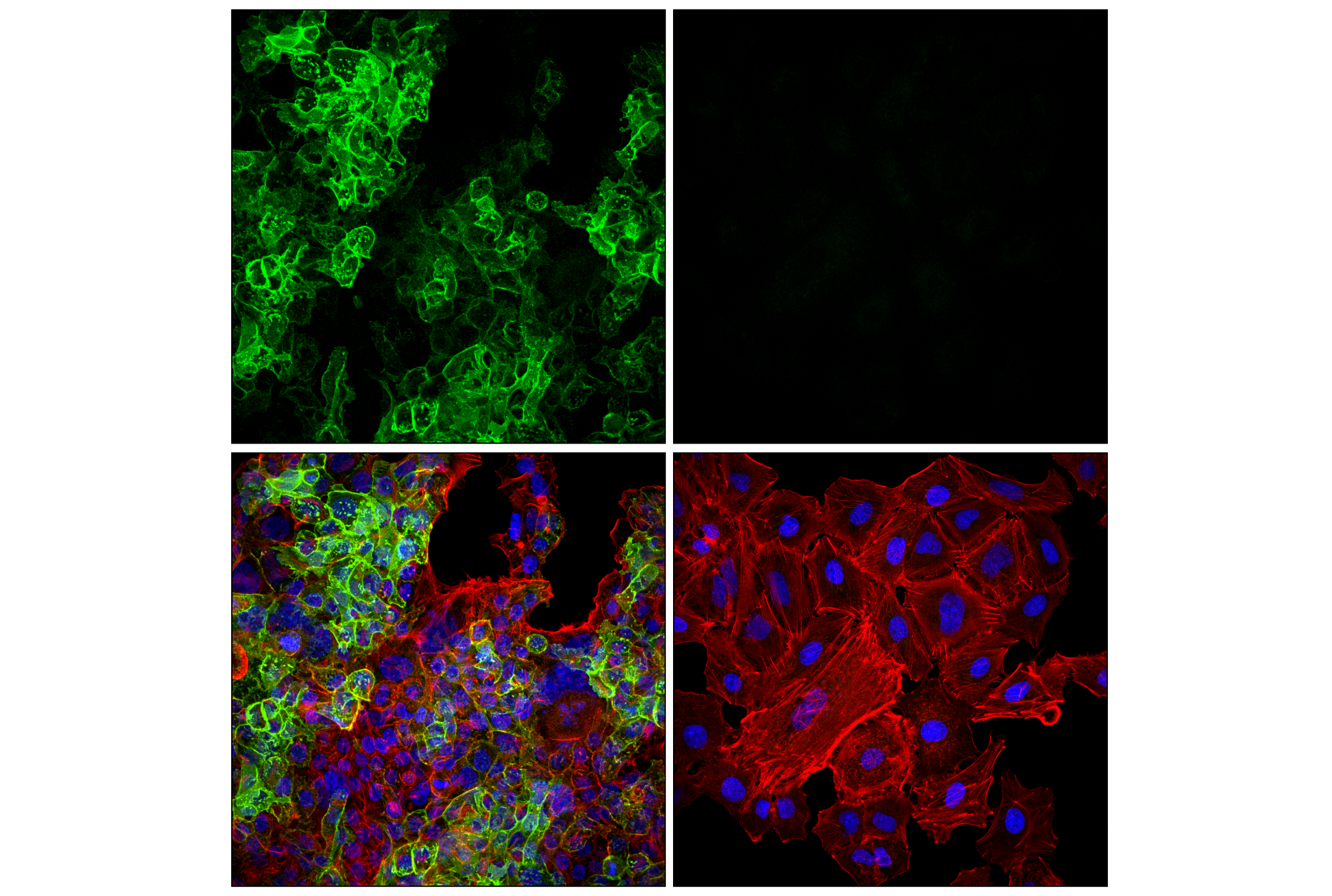 Immunofluorescence Image 3: EAAT1 (F8N7H) Mouse mAb