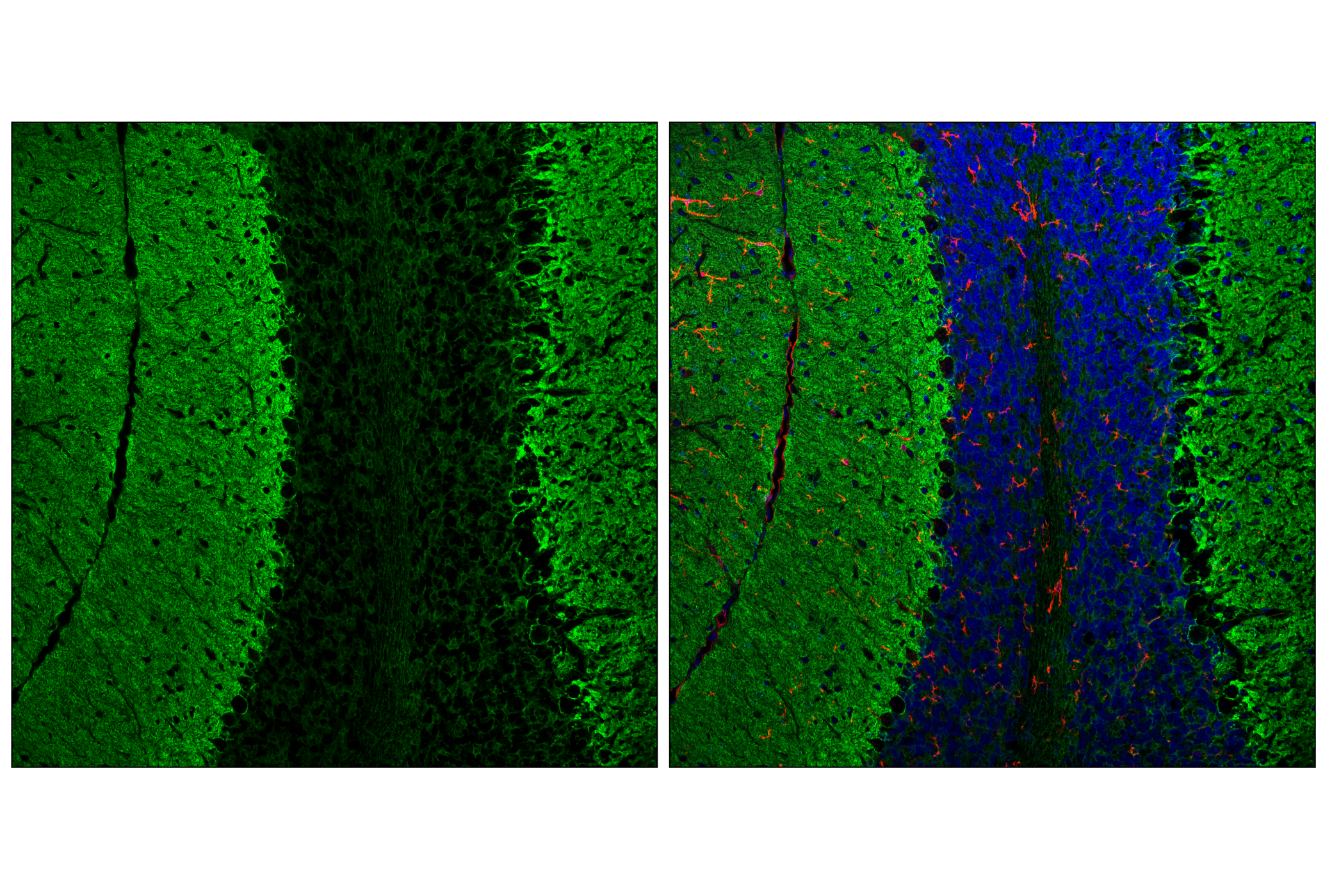 Immunofluorescence Image 1: EAAT1 (F8N7H) Mouse mAb