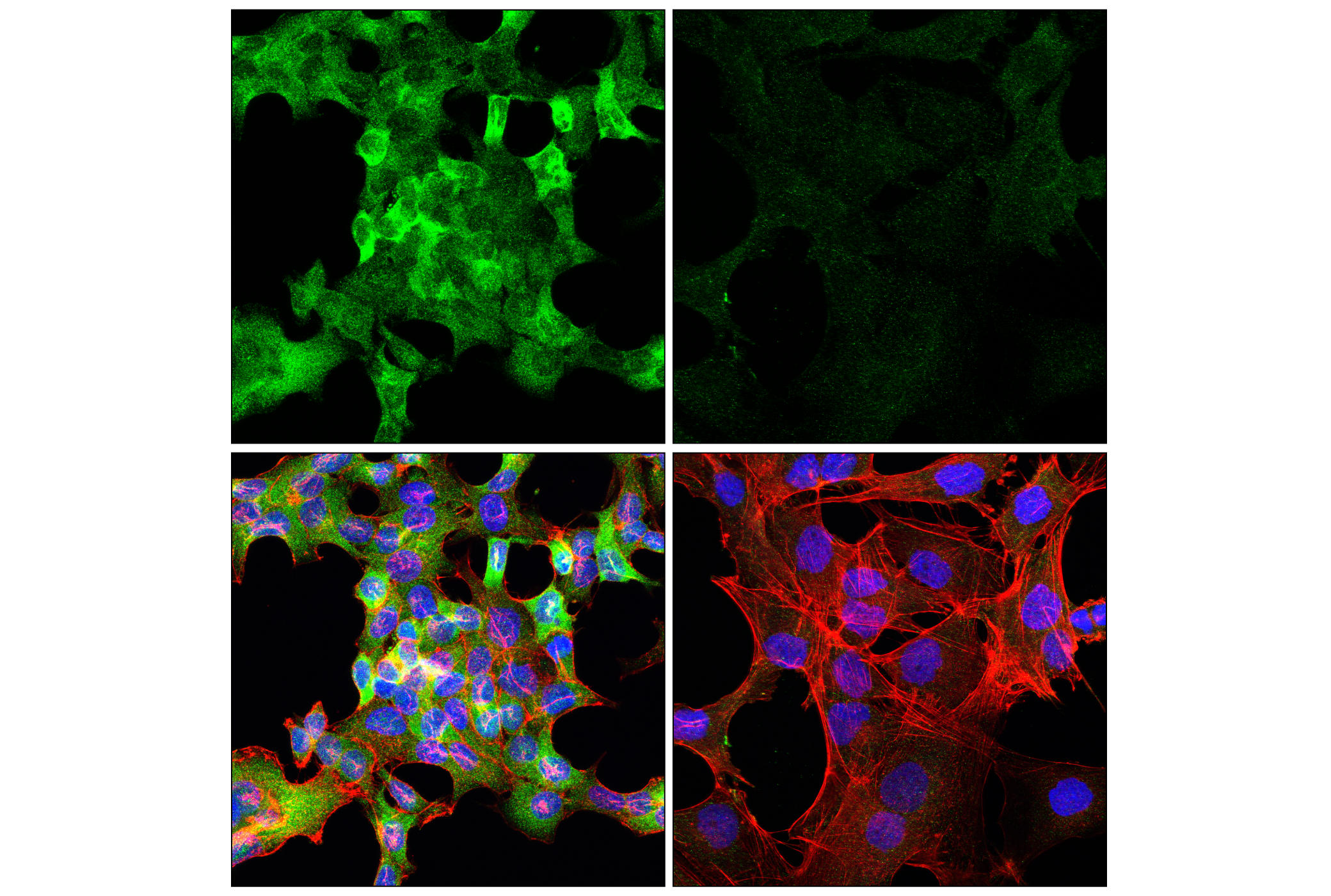 Immunofluorescence Image 1: GCLC (E2Y7D) Rabbit mAb