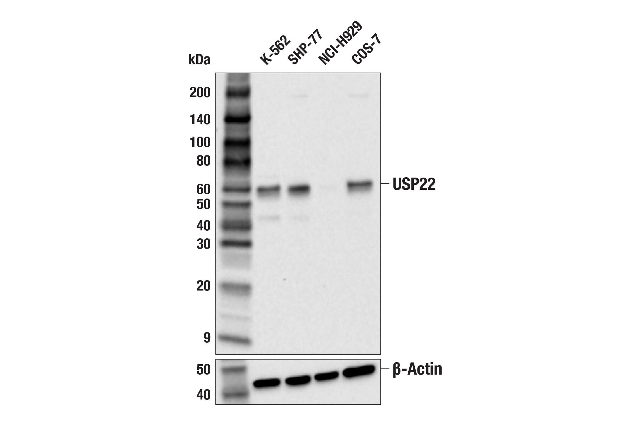 Western Blotting Image 1: USP22 (F4M4V) Rabbit mAb