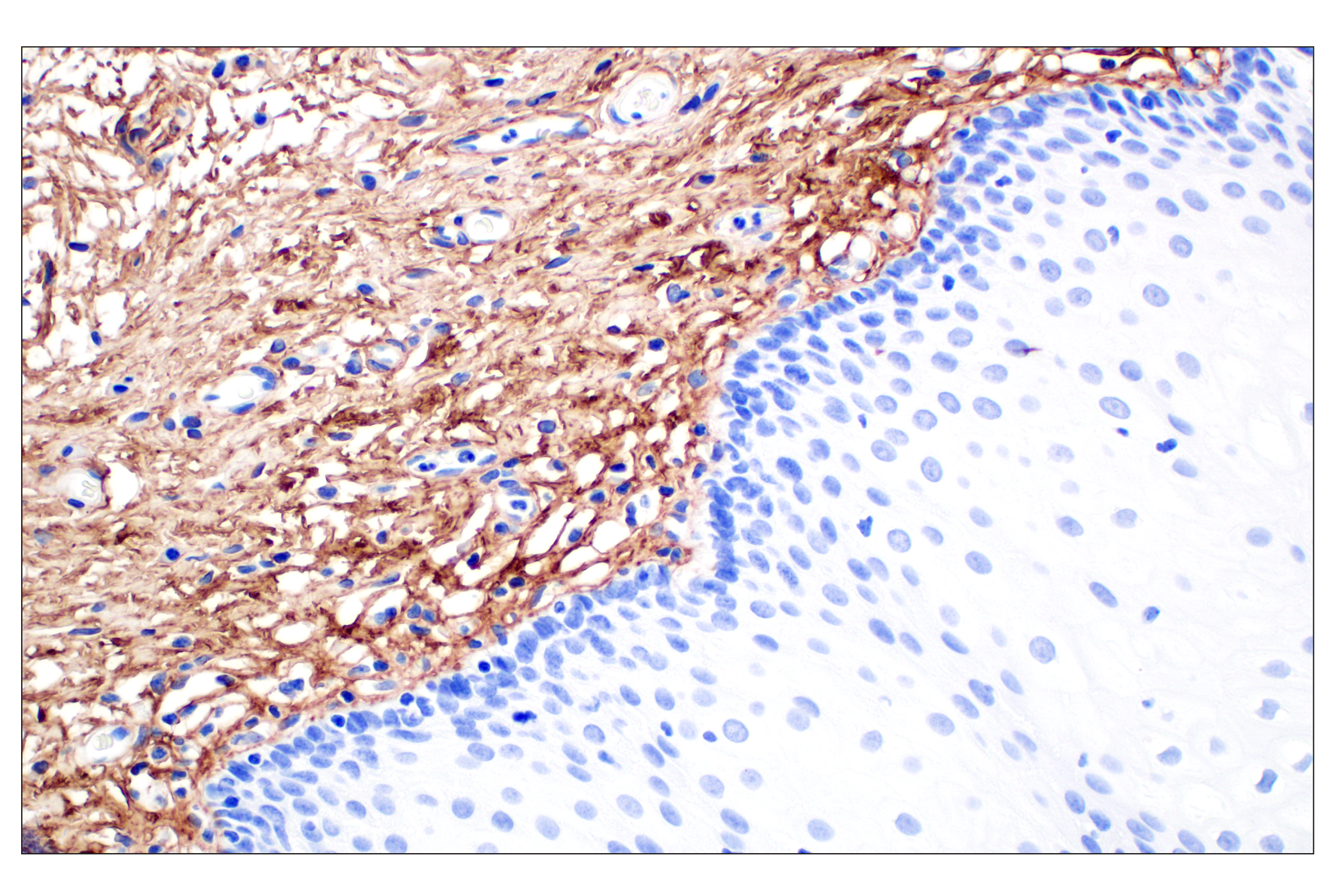 Immunohistochemistry Image 3: COL6A1 (E9U3B) Rabbit mAb