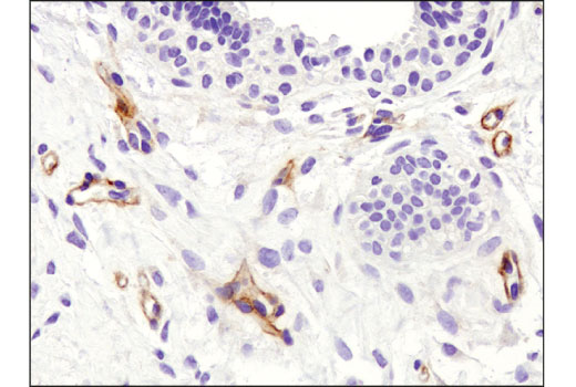  Image 14: Cancer-associated Growth Factor Antibody Sampler Kit