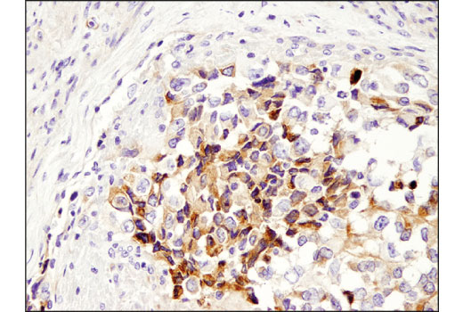  Image 23: Cancer-associated Growth Factor Antibody Sampler Kit