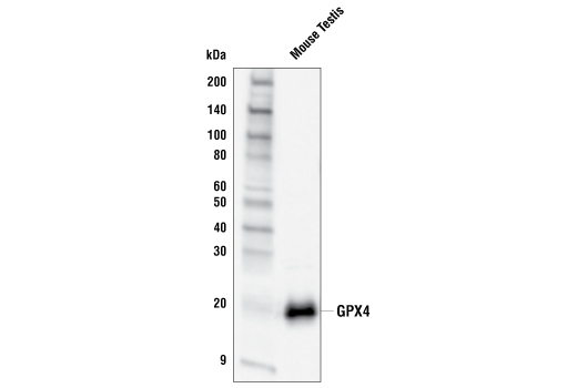 Western Blotting Image 2: GPX4 Antibody