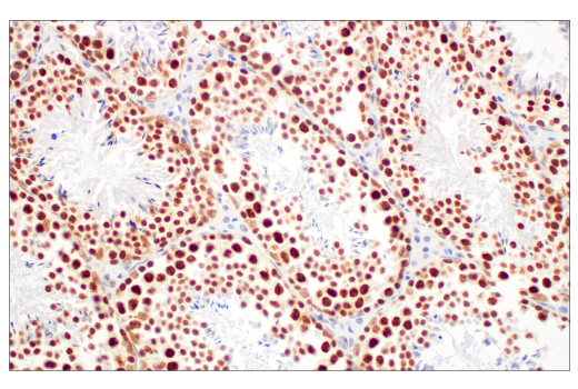  Image 34: Polycomb Group 2 (PRC2) Antibody Sampler Kit