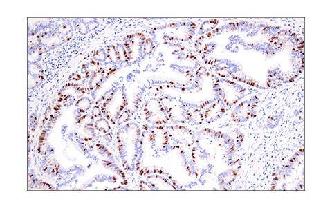  Image 26: Cell Cycle Phase Determination Antibody Sampler Kit