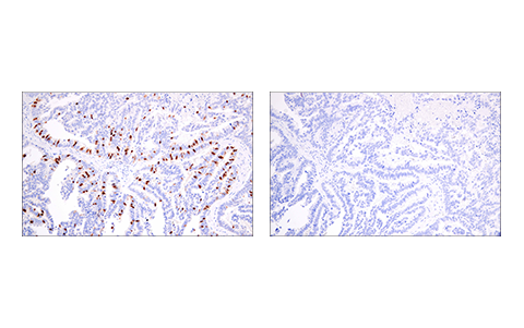  Image 30: Cell Cycle Phase Determination Antibody Sampler Kit