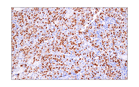  Image 33: Cell Cycle Phase Determination Antibody Sampler Kit